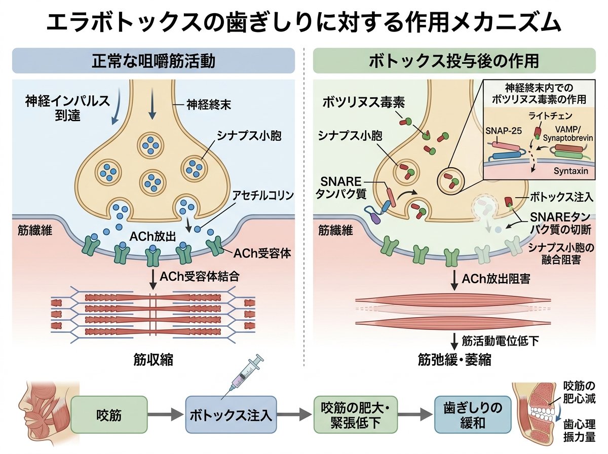 エラボトックスの歯ぎしりに対する作用メカニズム