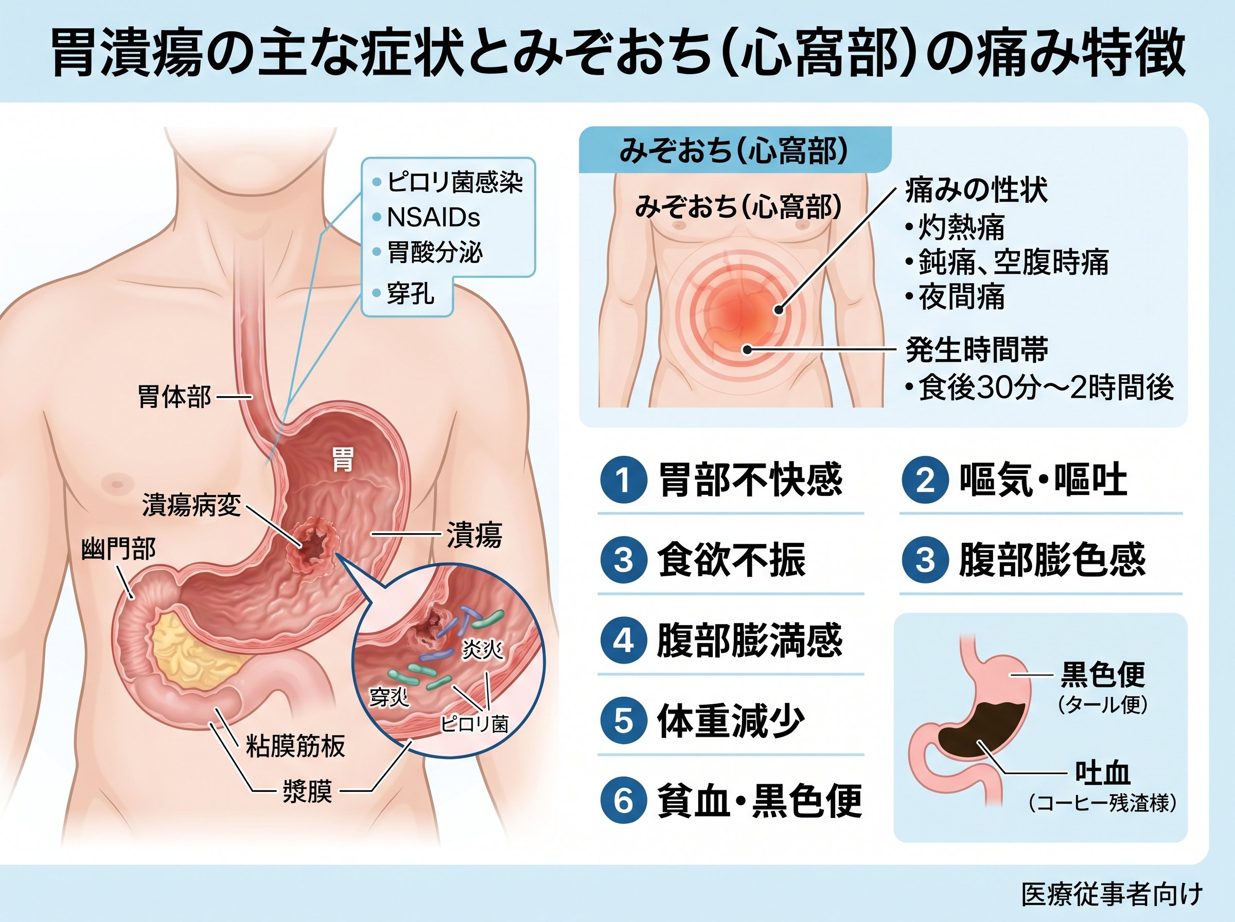 胃潰瘍の主な症状とみぞおち部分の痛み特徴