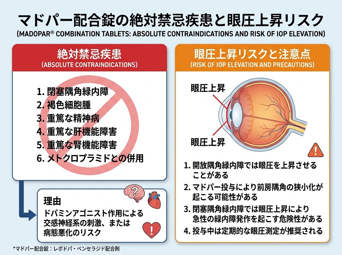 マドパー配合錠の絶対禁忌疾患と眼圧上昇リスク