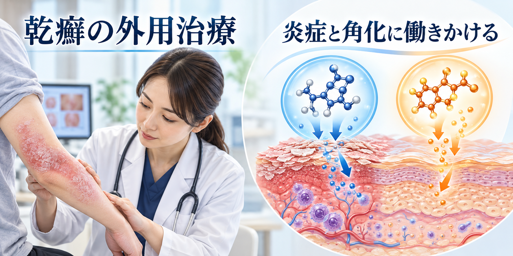 ドボベット適応症と処方基準の解説図