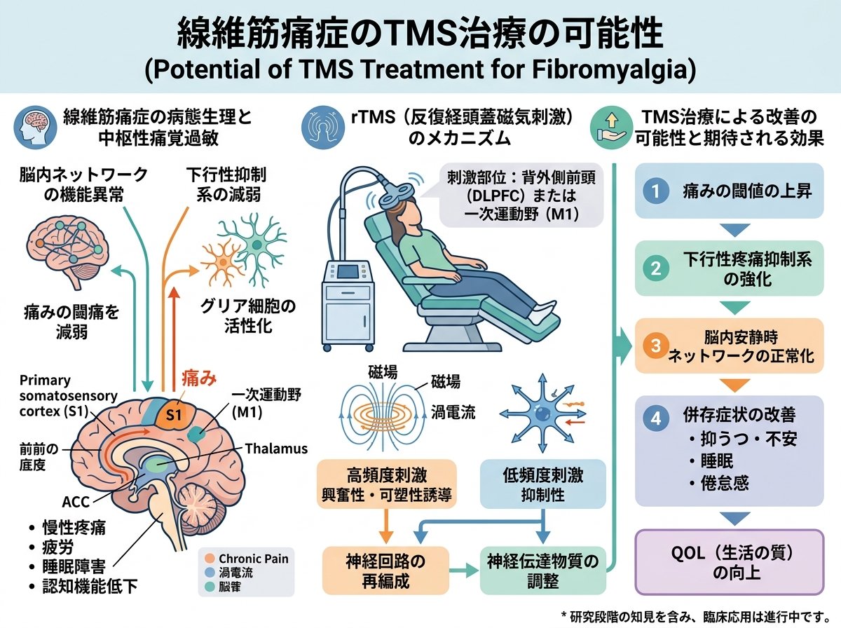 線維筋痛症のTMS治療の可能性